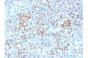 Image no. 7 for anti-Spleen Focus Forming Virus (SFFV) Proviral Integration Oncogene Spi1 (SPI1) (AA 16-170) antibody (ABIN6940631)