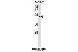 Image no. 1 for anti-Ectonucleotide Pyrophosphatase/phosphodiesterase 5 (ENPP5) (AA 404-431), (C-Term) antibody (ABIN1537281)