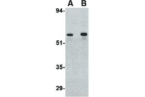 Image no. 2 for anti-Plexin Domain Containing 2 (PLXDC2) (C-Term) antibody (ABIN6656336)