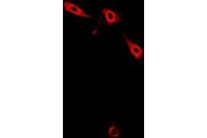 Image no. 1 for anti-LIM and Senescent Cell Antigen-Like Domains 1 (LIMS1) (full length) antibody (ABIN6005346)