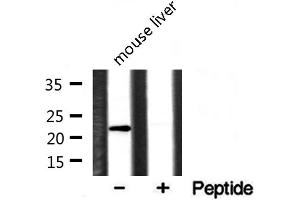 Image no. 2 for anti-Claudin 1 (CLDN1) antibody (ABIN6260877)