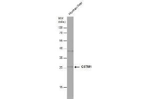 Image no. 3 for anti-Glutathione S-Transferase mu 1 (GSTM1) (Center) antibody (ABIN2856903)