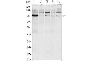 Image no. 3 for anti-Endoplasmic Reticulum To Nucleus Signaling 1 (ERN1) (AA 282-433) antibody (ABIN969116)
