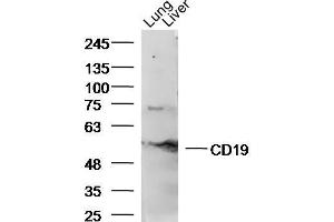Image no. 5 for anti-CD19 Molecule (CD19) (AA 151-250) antibody (ABIN1387313)