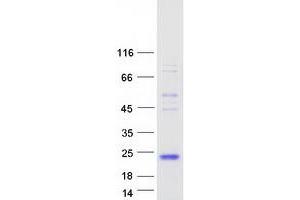 Image no. 1 for Follicle-Stimulating Hormone (FSH) (Transcript Variant 1) protein (Myc-DYKDDDDK Tag) (ABIN2721297)