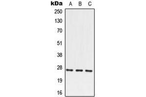 Image no. 1 for anti-Paired Related Homeobox 2 (PRRX2) (N-Term) antibody (ABIN2707714)