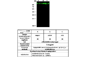Image no. 1 for anti-Lysosomal-Associated Membrane Protein 2 (LAMP2) (AA 1-375) antibody (ABIN6923992)