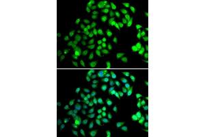 Image no. 3 for anti-Nuclear Cap Binding Protein Subunit 2 (NCBP2) antibody (ABIN6144401)
