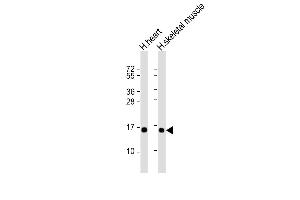 Image no. 1 for anti-Tumor Suppressor Candidate 2 (TUSC2) antibody (ABIN4914960)