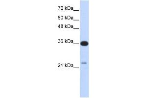 Image no. 1 for anti-TP53 Target 5 (TP53TG5) (Middle Region) antibody (ABIN634431)