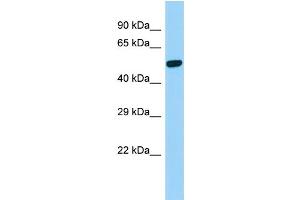 Image no. 1 for anti-Presenilin 2 (Alzheimer Disease 4) (PSEN2) (C-Term) antibody (ABIN2781803)