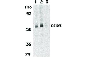 Image no. 1 for anti-Chemokine (C-C Motif) Receptor 3 (CCR3) (C-Term) antibody (ABIN6656645)