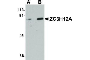Image no. 1 for anti-Zinc Finger CCCH-Type Containing 12A (ZC3H12A) (Internal Region) antibody (ABIN6655604)