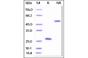 Image no. 3 for Tumor Necrosis Factor (Ligand) Superfamily, Member 13b (TNFSF13B) (AA 134-285) (Active) protein (His tag,AVI tag,Biotin) (ABIN4949008)