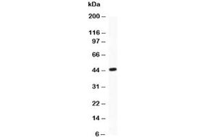 Image no. 7 for anti-Activating Transcription Factor 2 (ATF2) (AA 93-450) antibody (ABIN3029845)