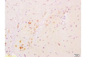 Image no. 5 for anti-Glial Cell Line Derived Neurotrophic Factor (GDNF) (AA 121-211) antibody (ABIN736536)