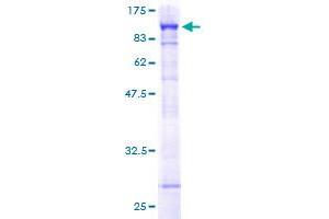 Image no. 1 for Poly A Specific Ribonuclease (PARN) (AA 1-639) protein (GST tag) (ABIN1314019)