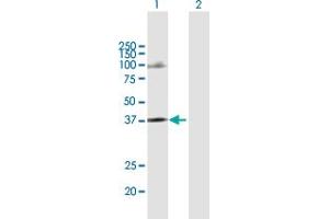 Image no. 2 for anti-Chemokine (C-C Motif) Receptor-Like 2 (CCRL2) (AA 1-344) antibody (ABIN522476)