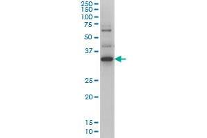 ZIC4 monoclonal antibody (M01), clone 4B1 Western Blot analysis of ZIC4 expression in Hela S3 NE .