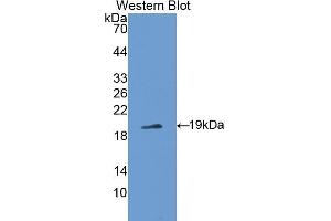 Image no. 1 for anti-Procollagen C-Endopeptidase Enhancer 2 (PCOLCE2) (AA 154-269) antibody (ABIN1176225)