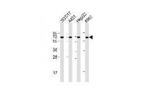 All lanes : Anti-F9 Antibody (Center) at 1:2000 dilution Lane 1: 293T/17 whole cell lysate Lane 2: A431 whole cell lysate Lane 3: HepG2 whole cell lysate Lane 4: K562 whole cell lysate Lysates/proteins at 20 μg per lane.
