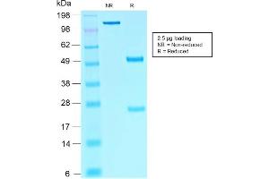 Image no. 1 for anti-SRY (Sex Determining Region Y)-Box 10 (SOX10) (AA 115-269) antibody (ABIN6940627)