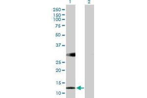 Western Blot analysis of RBP5 expression in transfected 293T cell line by RBP5 MaxPab polyclonal antibody.