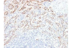 Recombinant TNFSF15 antibody
