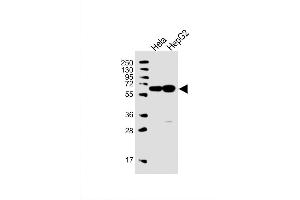 Image no. 3 for anti-UTP6, Small Subunit (SSU) Processome Component, Homolog (UTP6) (AA 16-43), (N-Term) antibody (ABIN651489)