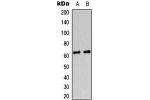 Image no. 2 for anti-Protein Kinase, AMP-Activated, gamma 2 Non-Catalytic Subunit (PRKAG2) (N-Term) antibody (ABIN2707330)