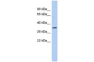 Image no. 2 for anti-Sirtuin 4 (SIRT4) (N-Term) antibody (ABIN2779655)