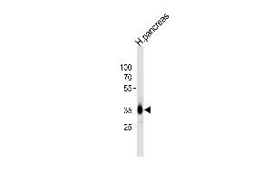 PPAP2A anticorps  (C-Term)