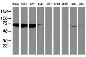 Image no. 1 for anti-N-Myristoyltransferase 2 (NMT2) antibody (ABIN1499784)