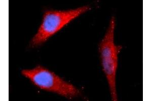 Image no. 1 for anti-Peptidylprolyl Isomerase G (Cyclophilin G) (PPIG) (AA 1-175) antibody (APC) (ABIN5567267)