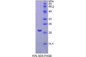 Image no. 3 for Fibroblast Growth Factor 13 (FGF13) ELISA Kit (ABIN6574103)