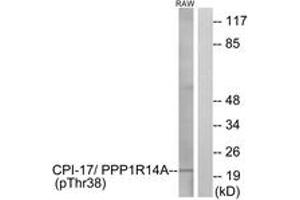 Image no. 1 for anti-Protein Phosphatase 1, Regulatory (Inhibitor) Subunit 14A (PPP1R14A) (AA 5-54), (pThr38) antibody (ABIN1531810)