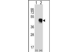 Western blot analysis of FCGR2A (arrow) using rabbit polyclonal FCGR2A Antibody (C-term) (ABIN657646 and ABIN2846641).