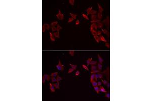 Image no. 2 for anti-Receptor (G Protein-Coupled) Activity Modifying Protein 3 (RAMP3) antibody (ABIN6146674)