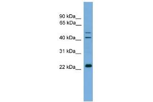 Image no. 1 for anti-Calcium Binding Protein P22 (CHP) (N-Term) antibody (ABIN2784874)