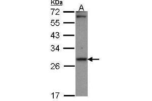 WB Image Sample (30 ug of whole cell lysate) A: A431 , 12% SDS PAGE Carbonyl reductase 1 antibody antibody diluted at 1:1000