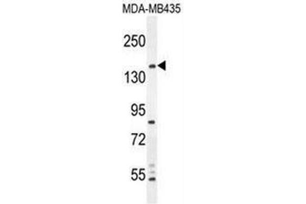 CAMSAP1 Antikörper  (N-Term)