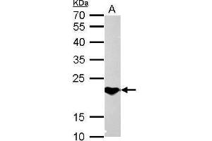 Image no. 4 for anti-Suppressor of Cytokine Signaling 1 (SOCS1) (C-Term) antibody (ABIN2854825)