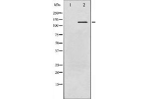 Image no. 2 for anti-C-Abl Oncogene 1, Non-Receptor tyrosine Kinase (ABL1) (pTyr245) antibody (ABIN6256686)