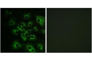 Immunofluorescence analysis of HeLa cells treated with EGF 200nM 5', using HER4 (Phospho-Tyr1284) Antibody.