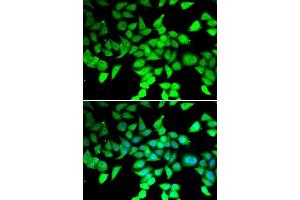 Image no. 2 for anti-Histone Deacetylase 7 (HDAC7) antibody (ABIN6141687)