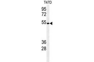 Image no. 1 for anti-Protein O-Glucosyltransferase 1 (POGLUT1) (AA 360-390), (C-Term) antibody (ABIN953123)