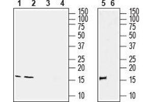 Western blot analysis of rat spleen (lanes 1 and 3), rat testis (lanes 2 and 4) and mouse spleen (lanes 5 and 6) lysates: - 1, 2, 5.