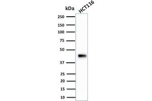 Image no. 1 for anti-Keratin 18 (KRT18) antibody (ABIN6939932)