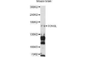 Image no. 2 for anti-Tonsoku-Like, DNA Repair Protein (NFKBIL2) antibody (ABIN6293687)