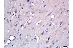 Formalin-fixed and paraffin embedded rat brain labeled with Rabbit Anti-BACE2 Polyclonal Antibody, Unconjugated (ABIN2170478) at 1:200 followed by conjugation to the secondary antibody and DAB staining